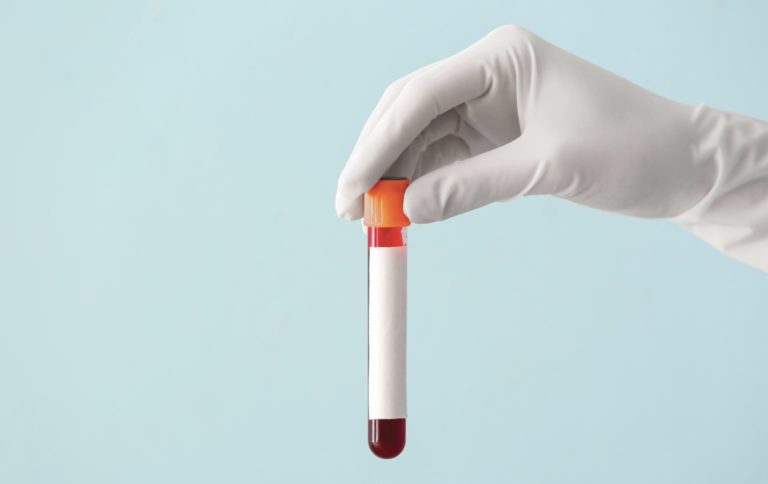 Understand Your Blood Test Results: Top Experts Weigh In